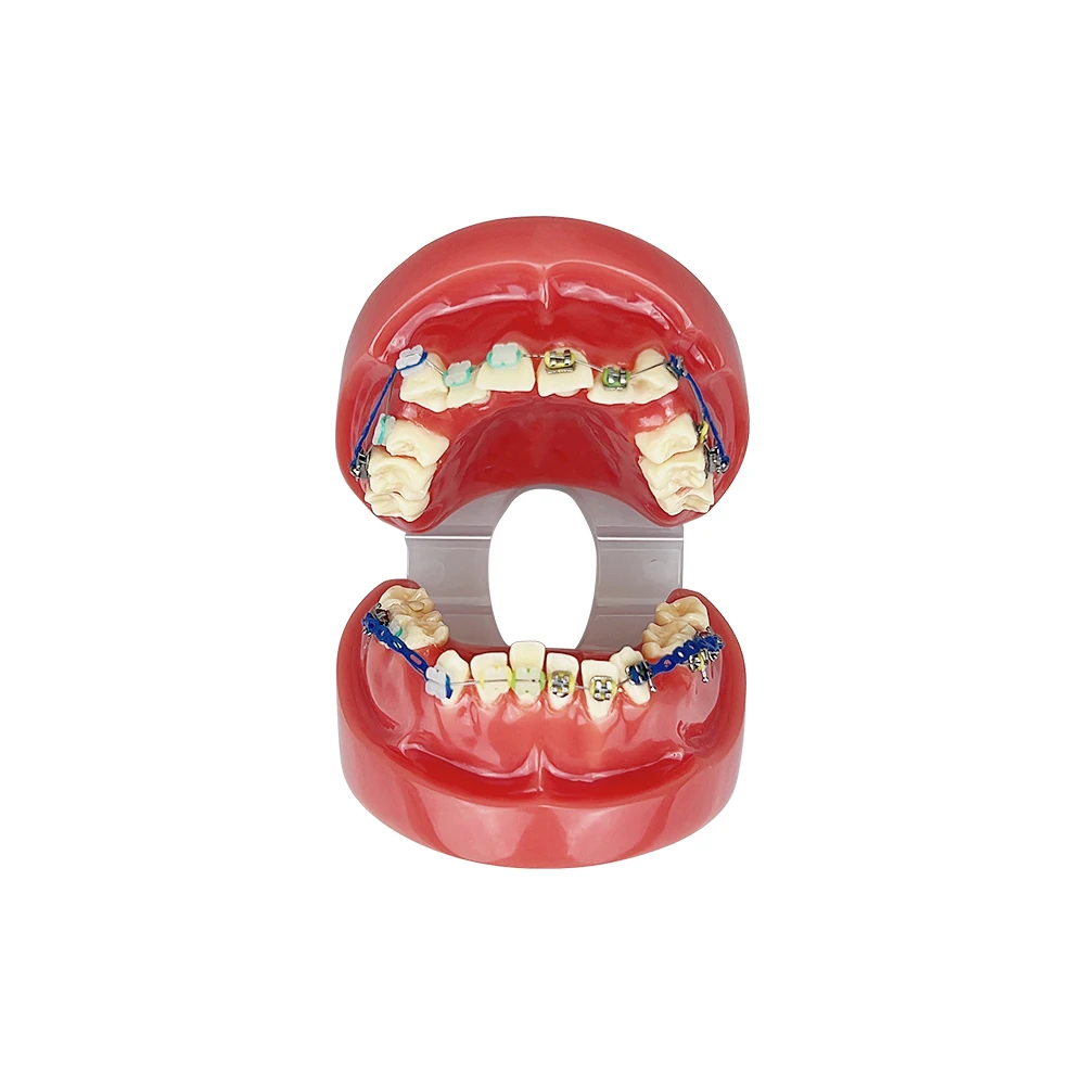 الأسنان تقويم الأسنان أنابيب فموية نموذج لشكل الأسنان سوء الحركة أورثو اللثة الأسنان المعدنية قوس السيراميك قوس سلك التدريس دراسة نموذج