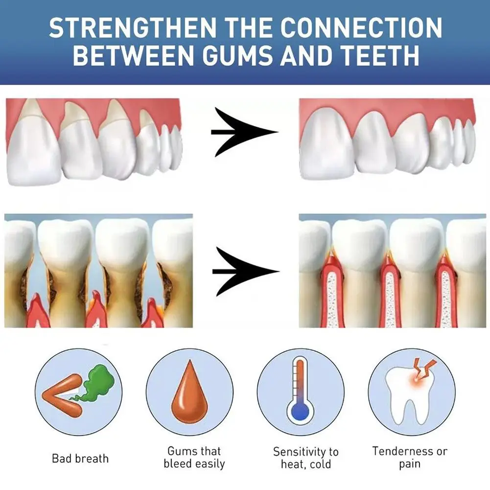 Gum Instant Treatment Gel Reduces Redness Promote Oral Hygiene Gum Health Treatment Inflamed Gums Mouth Cleaning Tools