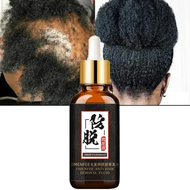 

Fast Wild Growth Hair Serum Oil Treatment for Hair Loss Natural Essence for Men Women EXTREME REPAIR For Bald spots