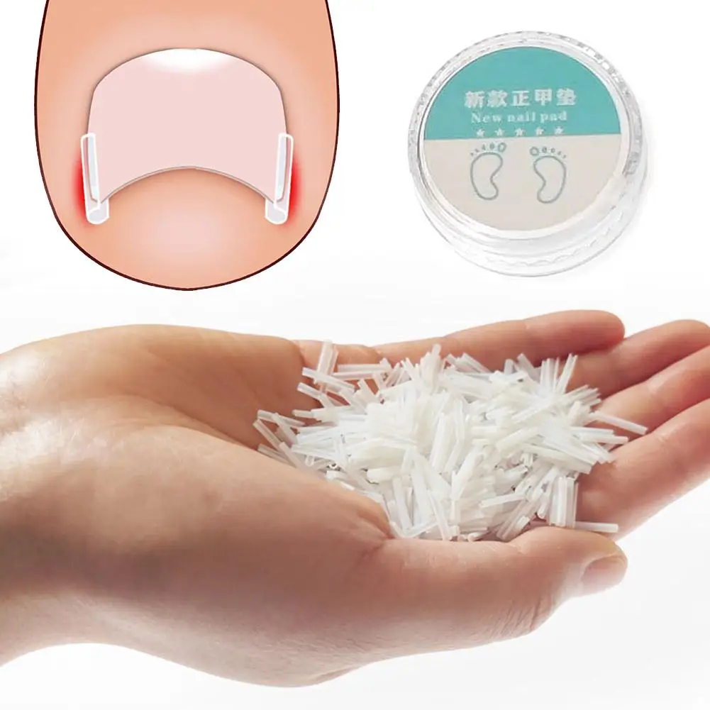 1Set Ingrown Toenai…