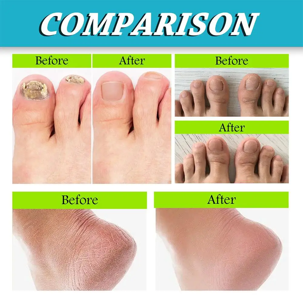 Shoe Foot Deodorizer Natural Deodorizer Spray Refreshing Foot Spray Odor Removal Sweatproof Foot Care Déodorant Perfume For Shoe