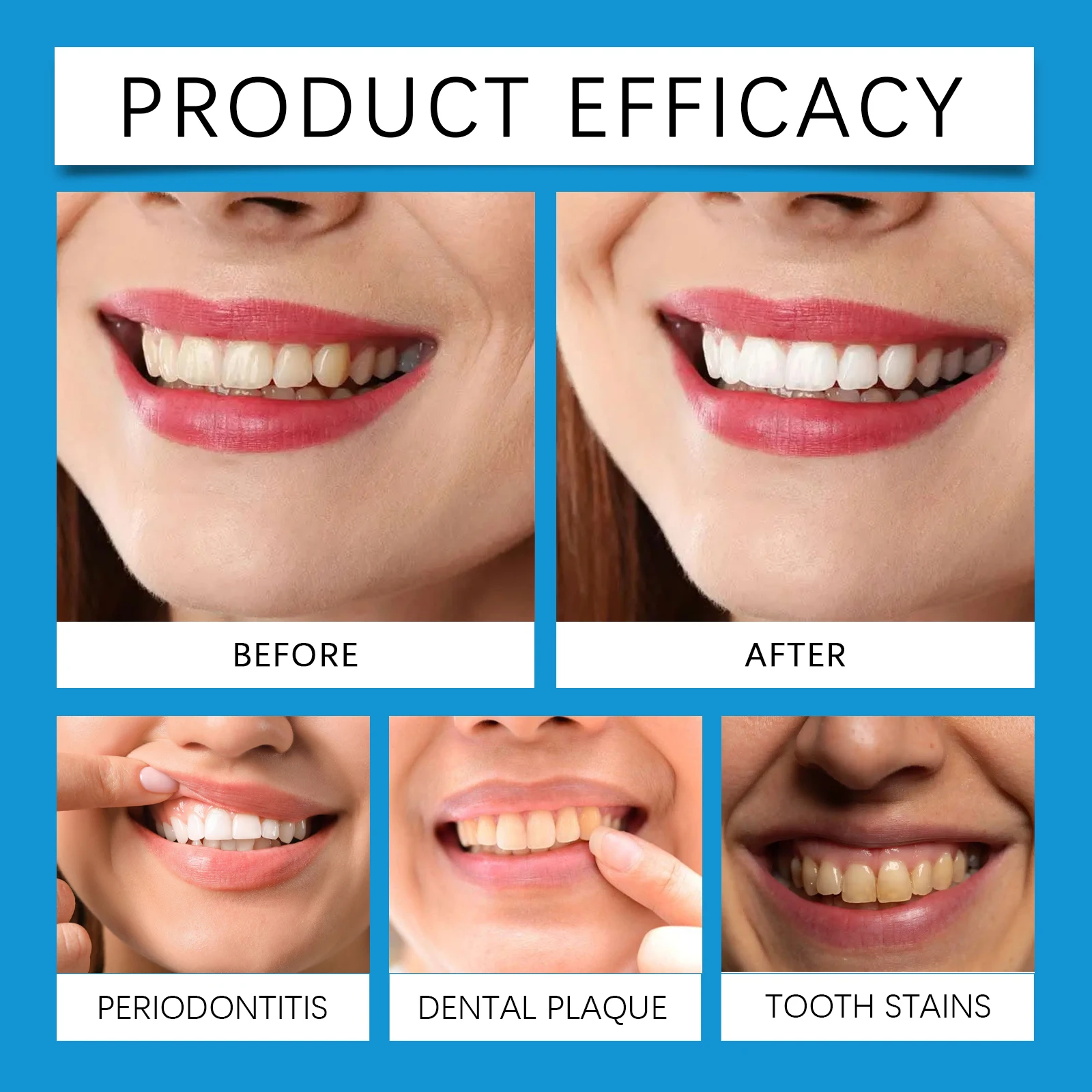 Professional Teeth Whitening LED Light Kit with 4X Whitening Gel Accelerated Whitening System Blue Light Tool for White Smile - view 6