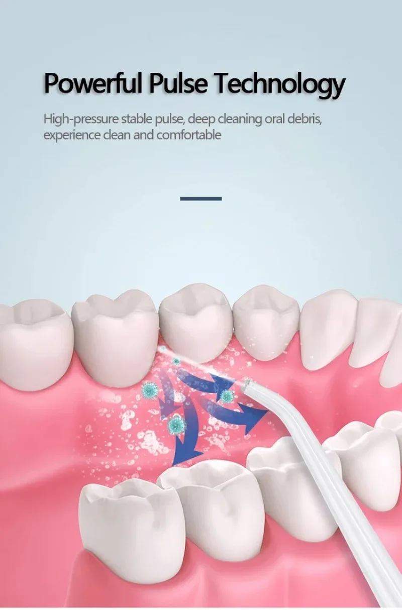 구강 세정기 치과 워터 제트 치실 기기 픽 치실 치과 입 세척기 치아 미백 청소 도구