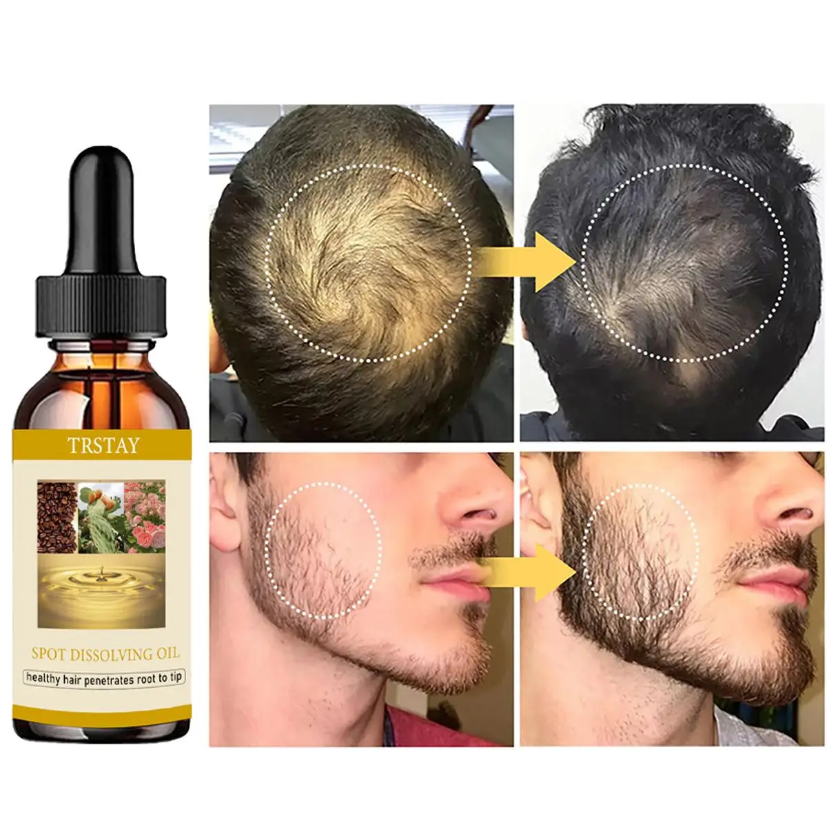 New 2022 A Powerful Hair Oil for Fast-growing Postpartum Hair Loss Hair Products  Hair Growth Oil