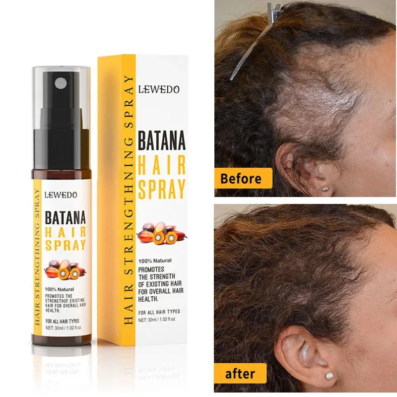 Batana Oil Hair Growth Products Fast Growth Batana Essence Oil Traction Alopecia Anti Hair Loss Baldness Treatment For Men Women