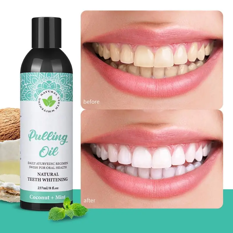 Coconut Oil Pulling Mouthwash,237ml Natural Essential Oils Alcohol Free Mouthwash,Helps with Fresh Breath, Teeth Whitening