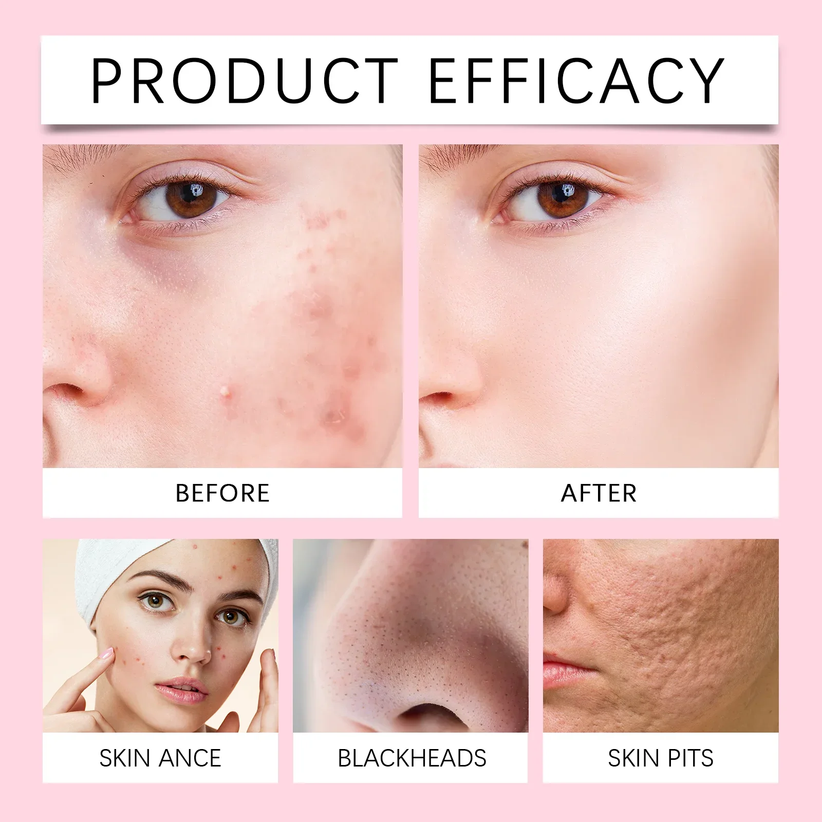 Oil Control & Pore Minimizing Facial Cleanser - Deeply Moisturize, Anti-Acne & Blackhead Removal, Exfoliating Face Wash