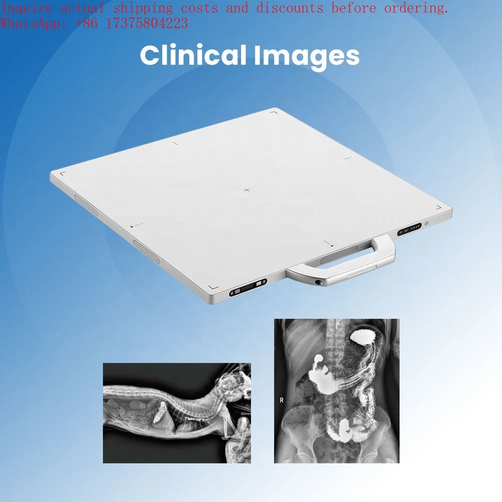 Wireless Flat Panel Detector for X-ray Systems 14x17 17x17 Inches High Resolution Digital Radiography Detector CE Certified 2