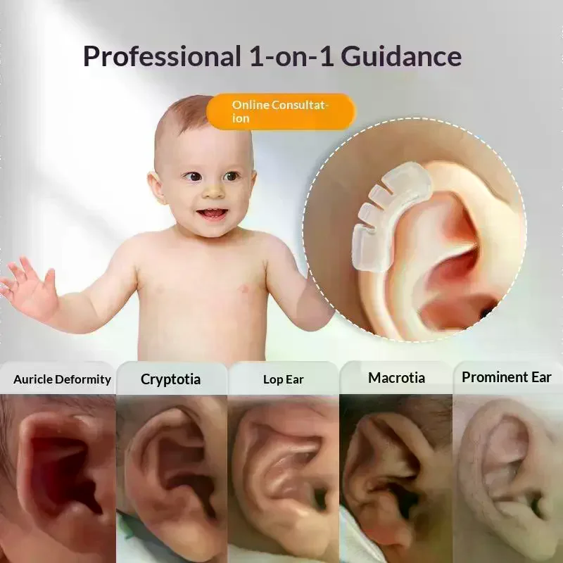 1pcs  IInfant Ear Correction Device Soft Silicone Ear Shaping Mold For Newborns Baby Adjustable Design Transparent Comfortable