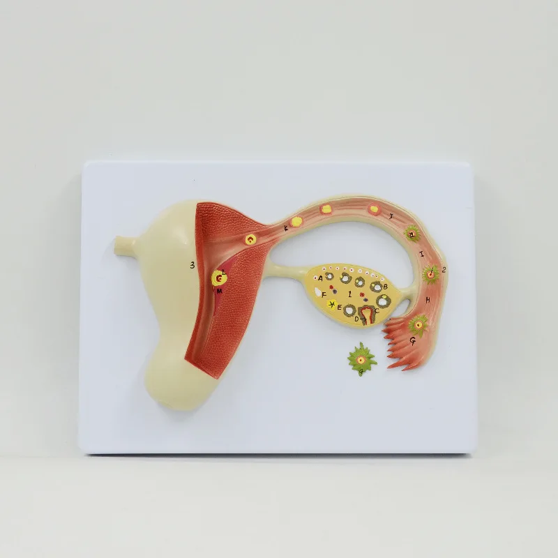 Enlargement model of human uterus and ovaries, teaching display mold