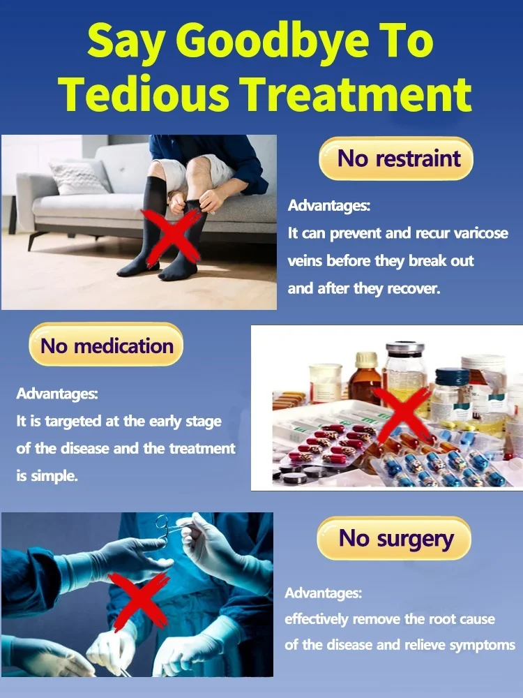 Say byebye to vasculitis, phlebitis, spider leg pain, varicose veins