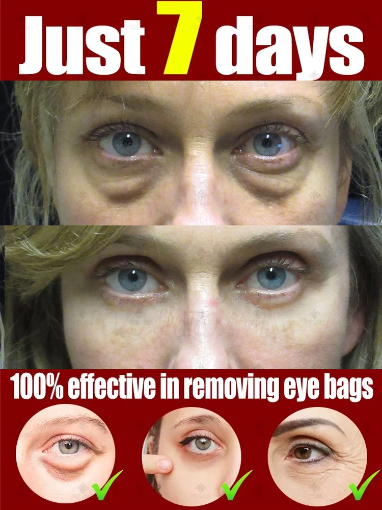 

Instantly Remove Eye Bags & Circles: Eye Cream to Reduce Fine Lines, Tighten Skin, and Fight Dark Bags for Smooth, Youthful Eyes
