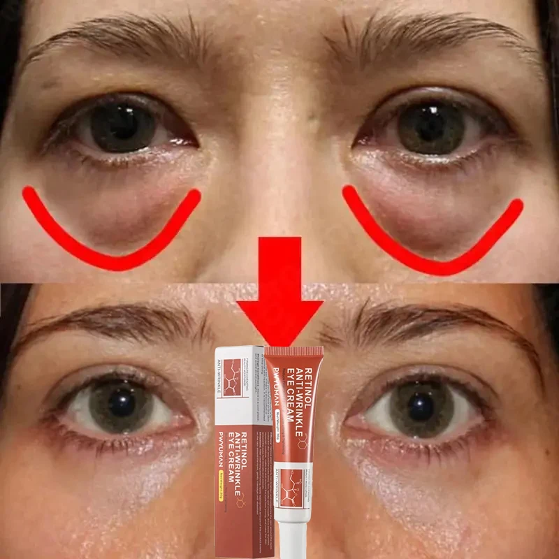 Instant Eye Bag Remove Eye Cream Anti Fat Particles Dark Circles Puffiness Fade Fine Lines Lift Brighten Korean Beauty Eye Care