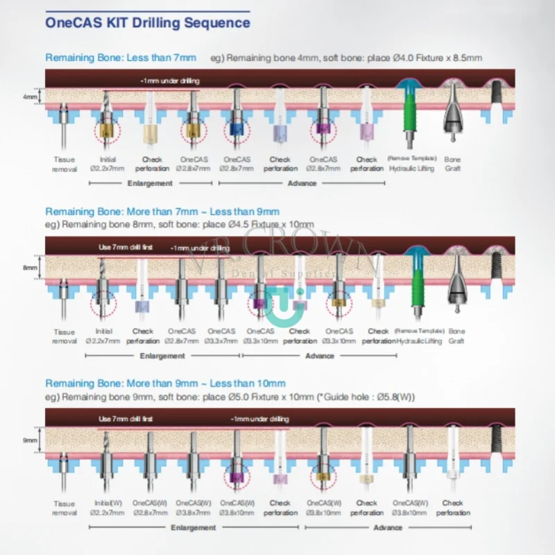 Onecas Kit - Guided Sinus Lift Chirurgie Kit Osstem Implantat Instrumenten Kits