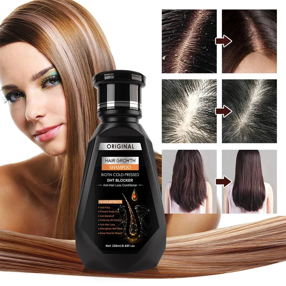 Hair Growth Ginger Shampoo Biotin Cold-pressed Anti-hair Loss Conditioner Massage Cream Hair Treatment for Hair Regrowth Care