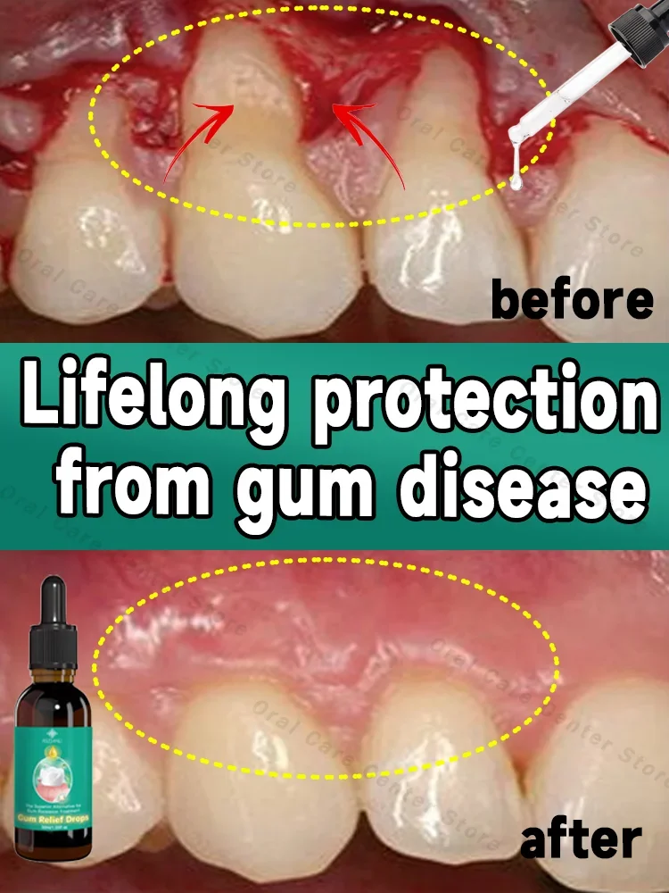 Protect gum health, quickly relieve toothache, repair damaged gums, and eliminate gum bleeding