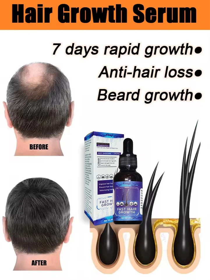 

Hot selling product, 99% of buyers buy again, say goodbye to baldness, have more and more hair, thick hair