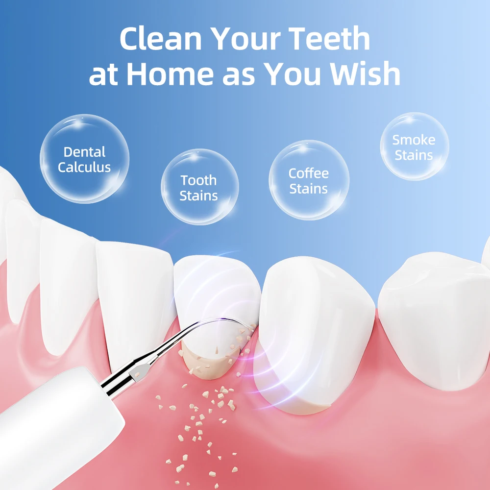 Thumbnail 3 - #38 Highest Rated Ultrasonic Dental Scalers to Buy in 2026
