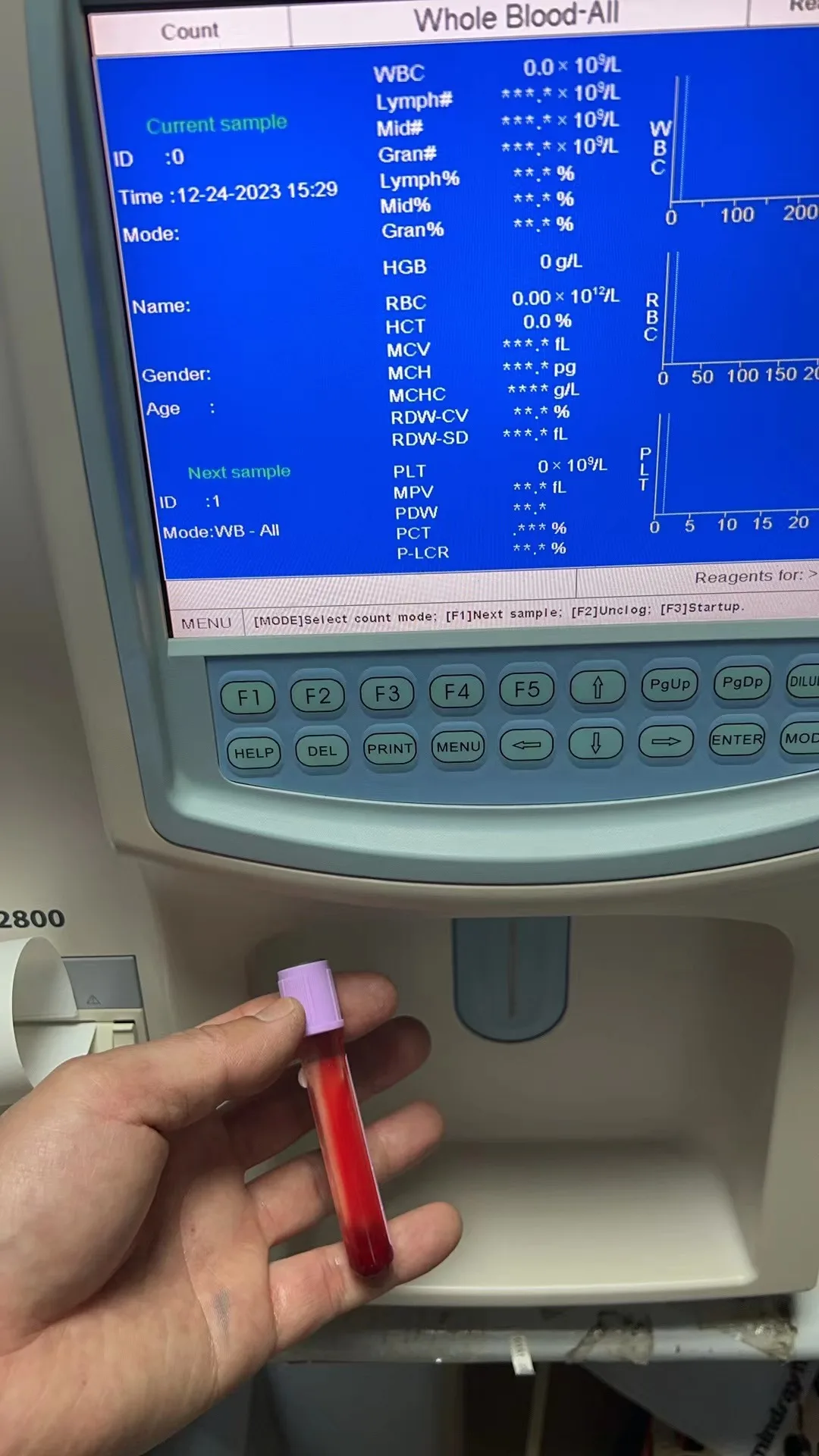 Mindray BC-2800 Auto Hematology Analyzer Fully automatic 3-part dierentiation of WBC Used Analyzer Almost New