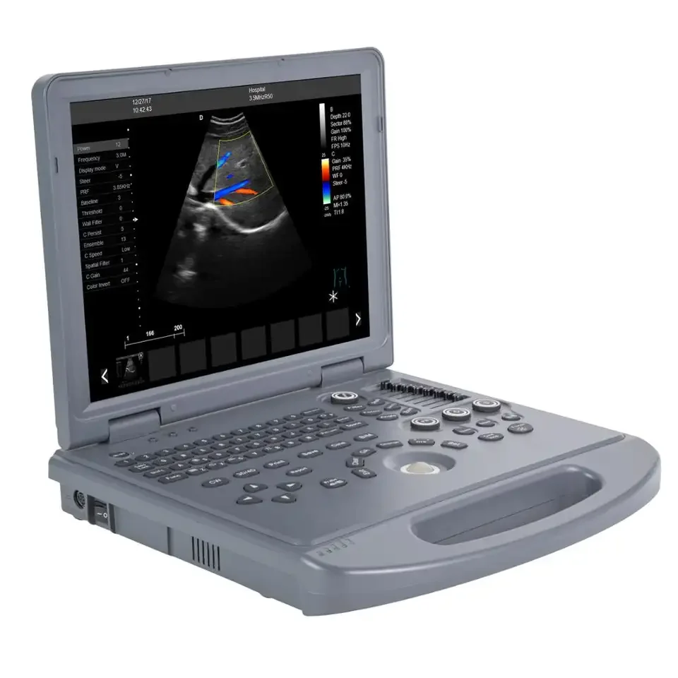 Hand-carried Portable Color Ultrasound Doppler for Hospital/Breast Ultrasound