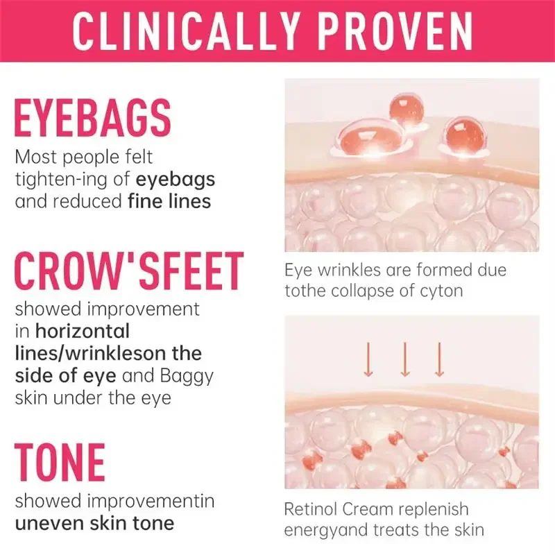 Bolsa de ojos instantánea, crema para eliminar Retinol, antiarrugas, reafirmante, decoloración de la piel, líneas finas, antiángulo oscuro, hinchazón, ilumina el cuidado de la piel de los ojos