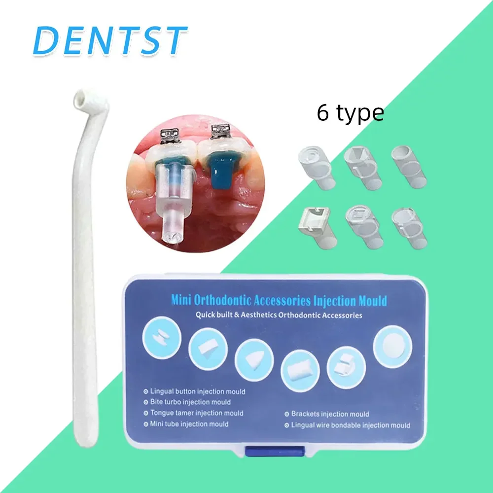 치과 교정 몰드 스타터 키트, 주입 몰드, 미니 성형 몰드 핸들, 설측 단추 바이트 터보 드라이버, 치과 액세서리, 1 세트