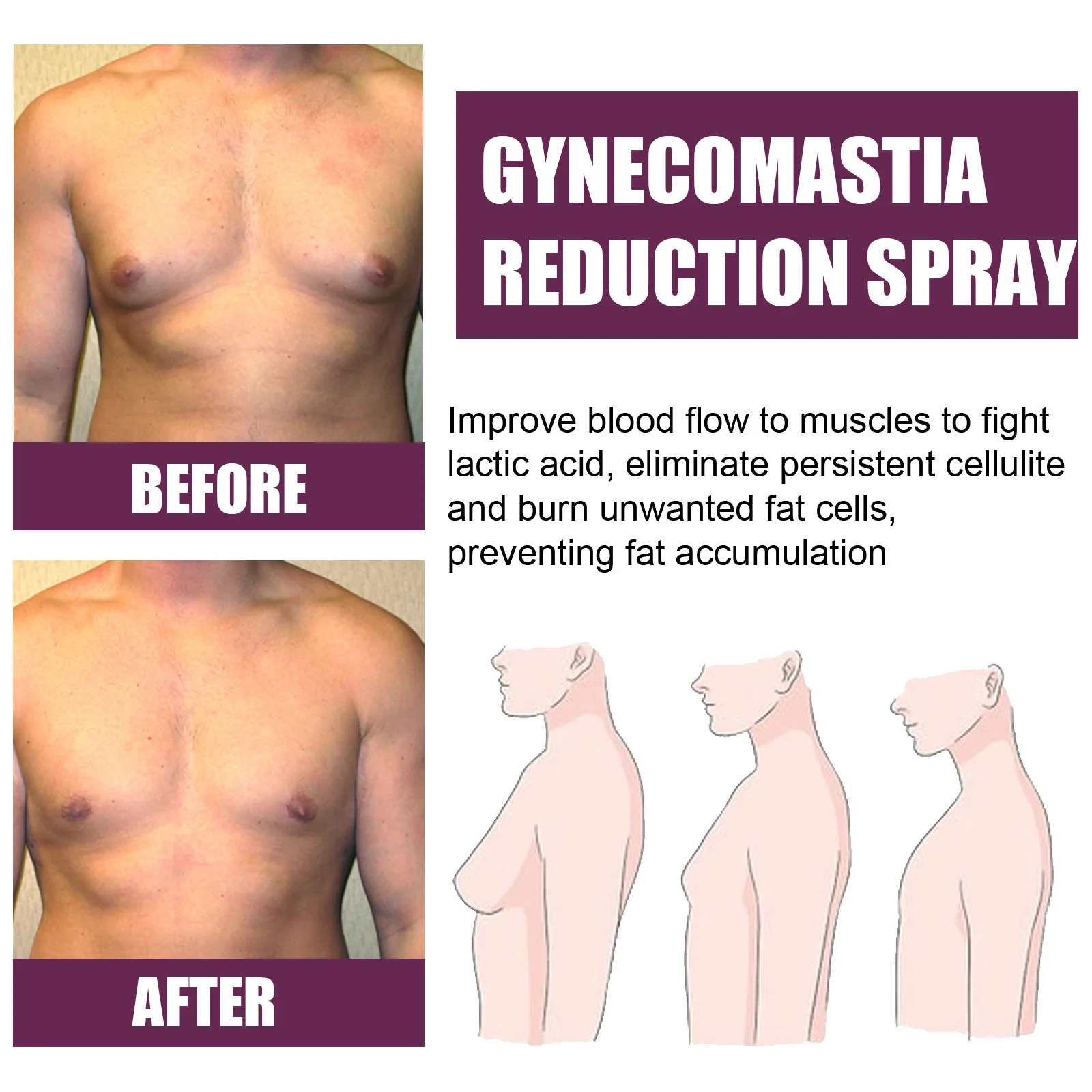 Gynecomastia Firming Spray Male Breast Growth Accelerating Pectoral Muscles Hardening Shrinking Chest Cellulite Reduction Spray