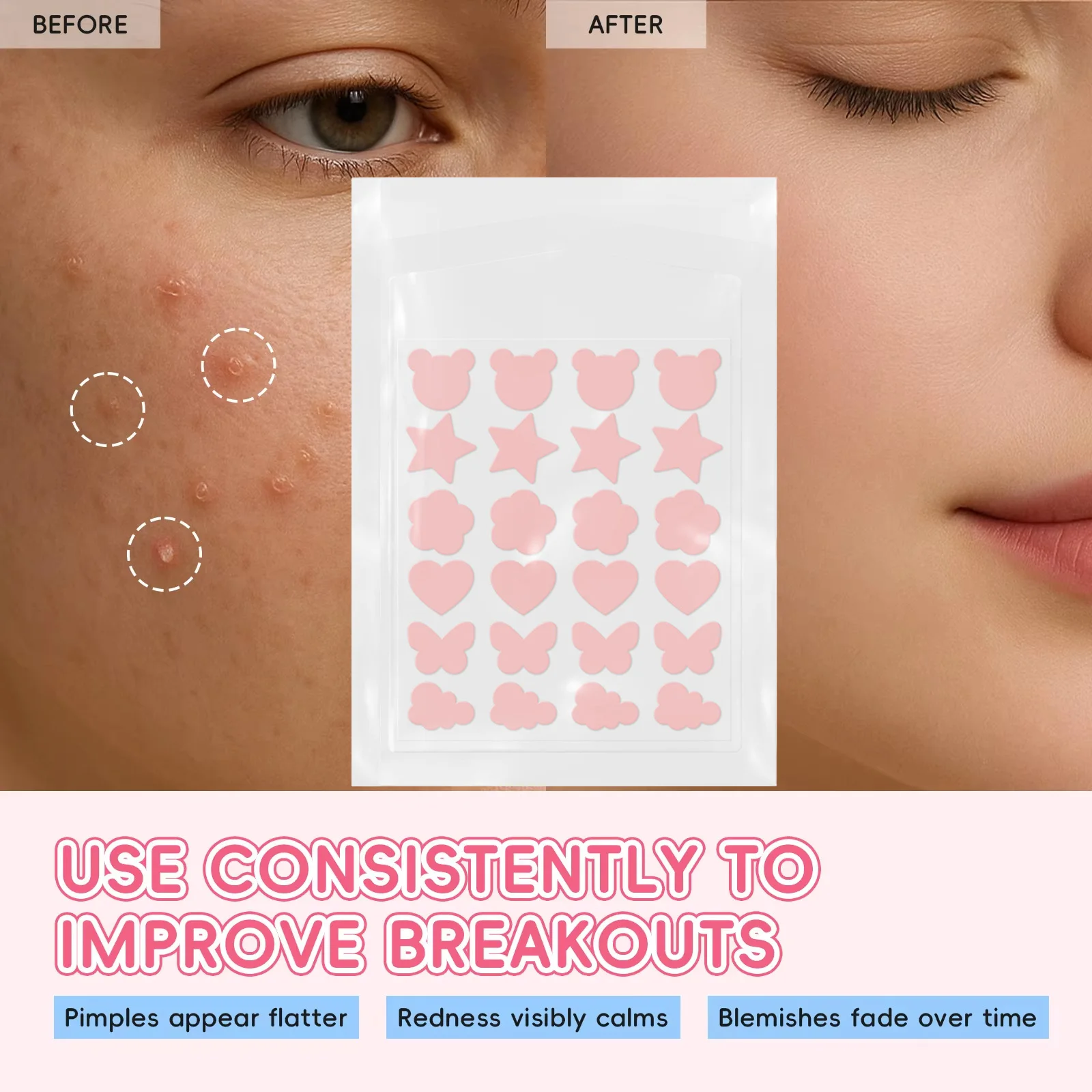Laikou Sakura Acne Patches 24 Pcs, Hydrocolloid Pimple Patches for Face, Invisible Spot Cover, Fast Healing Treatment