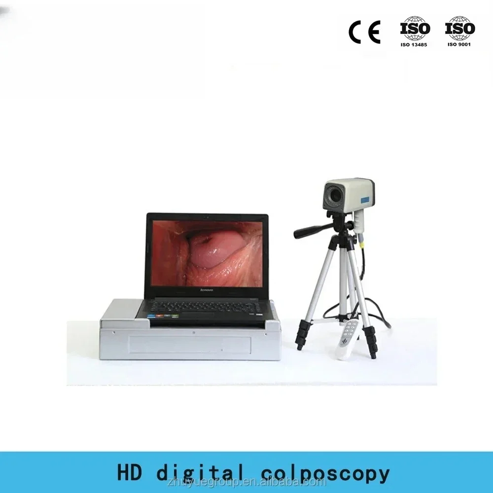 حار بيع فيديو نطاق كولبو الطبية الرقمية فيديو نطاق كولبو نطاق كولبو البصرية