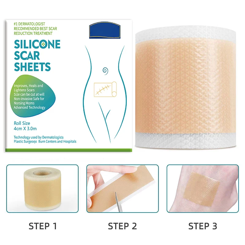 150/300 cm riparazione della pelle Gel di Silicone cicatrice foglio Patch trattamento rimozione nastro Acne Trauma bruciare cicatrice sezione bellezza dell'orecchio