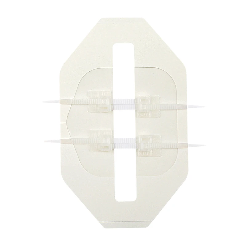 

Застежка-молния, пластырь для закрытия ран, пластырь на молнии, быстрый шов, портативный кровоостанавливающий пластырь для улицы, инструмент первой помощи