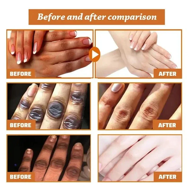 Fast Whitening Dark Knuckles Brighten Hand Cream Melanin Corrector Moisturizing Intense Stains Remover Cosmetics Skin Care 2024