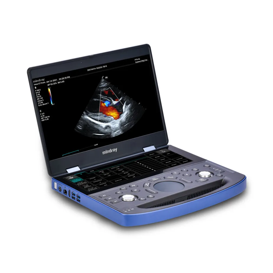 Mindray Veterinary  Ultrasound Vetus E7 Hand-Carried Veterinary Ultrasound System