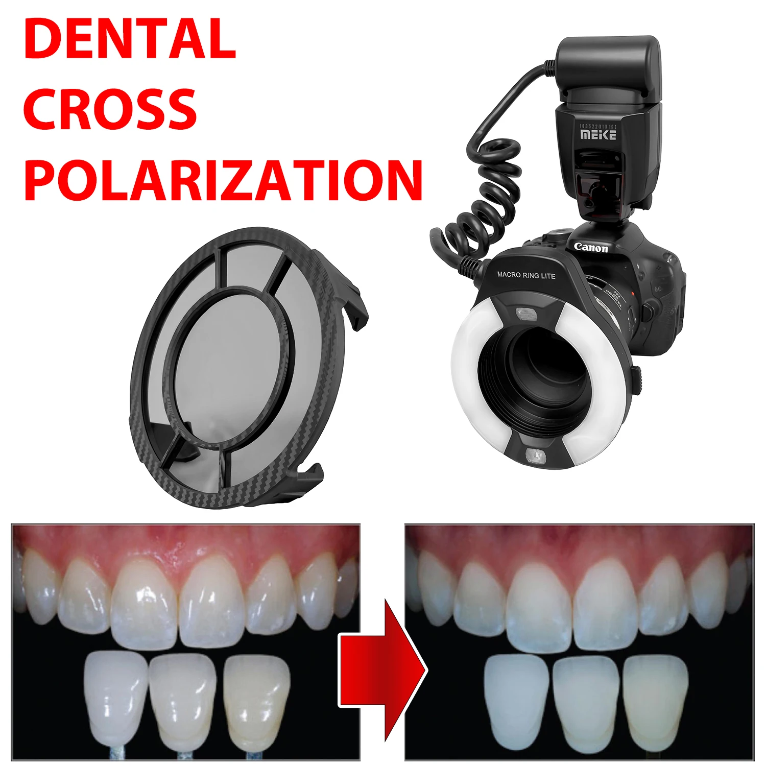 Cross Polarizing Lens Filter For Dental Photography - No Glare, No Relfection Polar Eye Photos For Dentist For MEIKE Flash