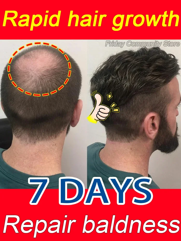 

99% of buyers buy again, have more and more hair, say goodbye to baldness, thick hair,Hot selling product