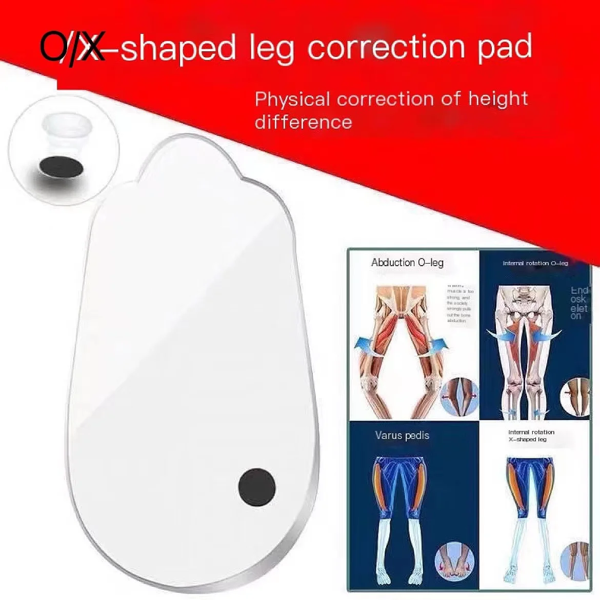 X/ O-shaped Leg Correction Insole Inside Eight Figure Outside Eight Straighten Healthy Beautiful Legs Correct Looped Legs