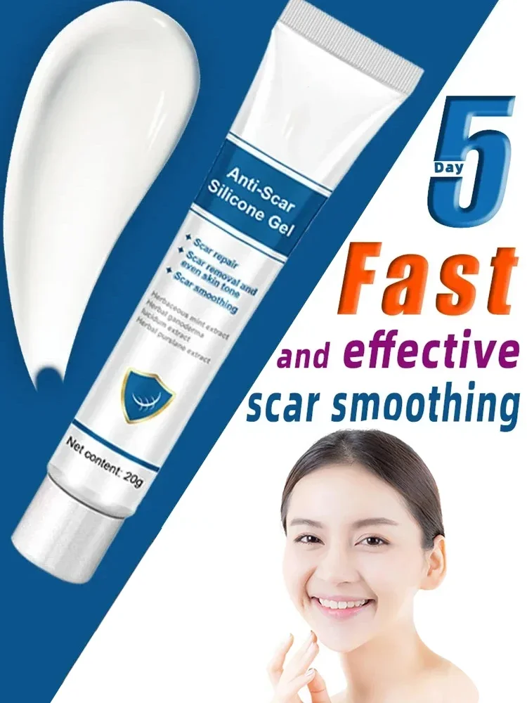 Fast Scar Removal Cream Scar Removal Cream Gel Removal Ointment From Keloid Treatment Stretch Marks Burn Surgical Scars