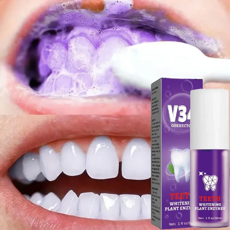 

Korean Teeth Cleansing Whitening Toothpaste: Stain & Yellow Removal, Fresh Breath, Deep Clean & Whitening, Oral Care