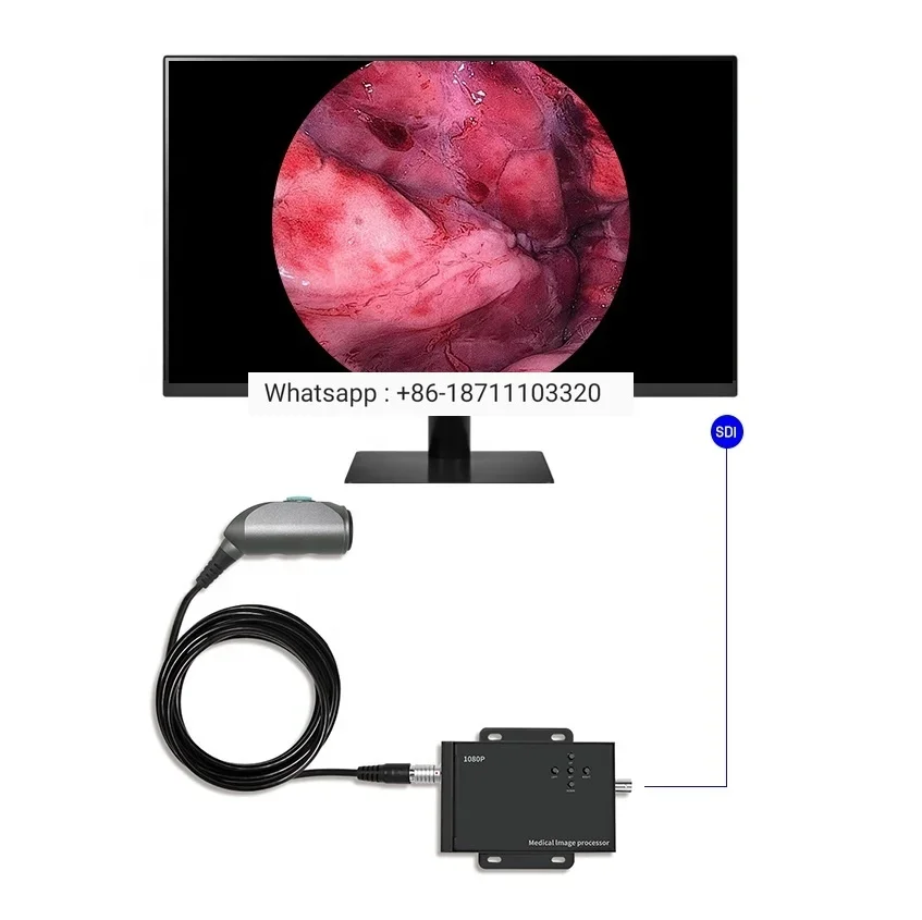 

Cheap Portable Medical Veterinary Endoscope Price with 1080P Fhd Ent Endoscopy Camera