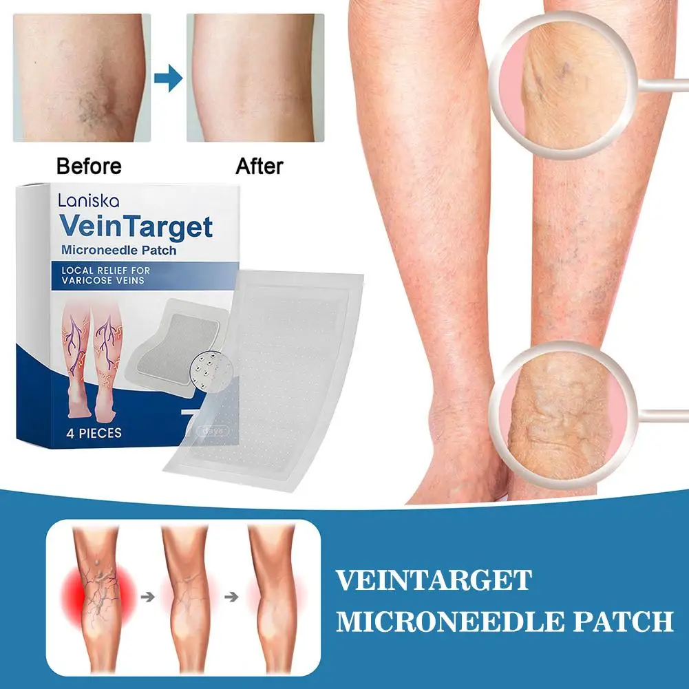 Varicose Vein Relief Patches with Cooling Plant Extracts Non Greasy Promotes Blood Circulation Lightweight Easy to Apply view 2