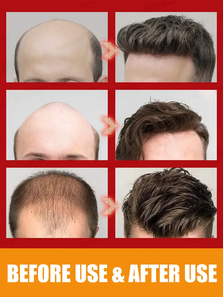 El verano viene: listo para su nuevo look.