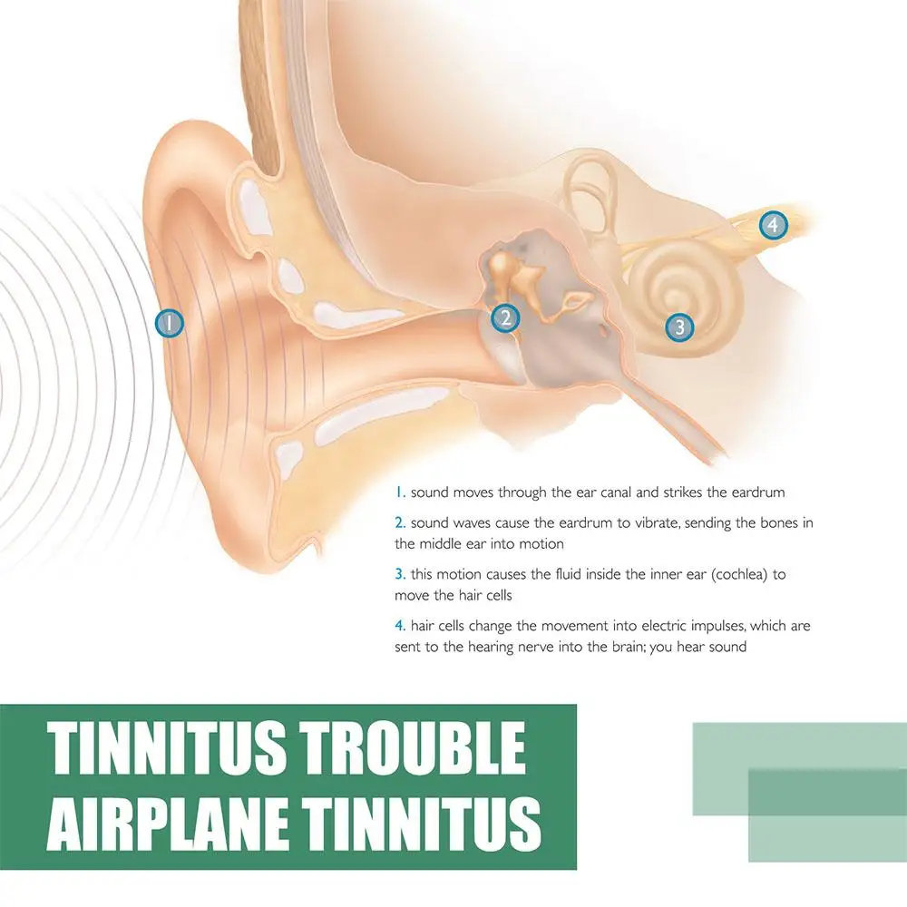 20ml tinnitus Búzakalász Gyógycseppek Búzakalász Csengetés Árverseny relieving Egészég Beszédmód érdekel tinnitus Cseppfolyós Búzakalász Búzakalász Siketség Buggy Fülgyulladás érdekel