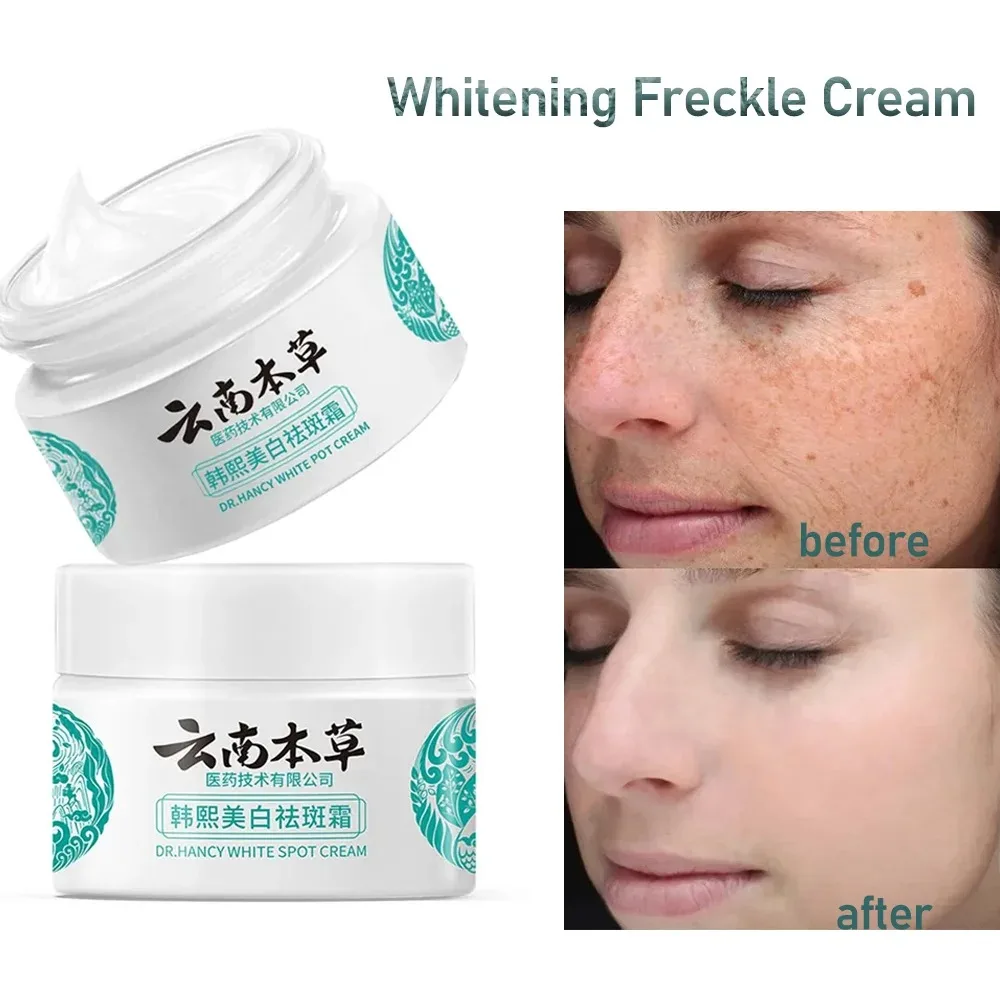 

Yunnan Herbal Whitening Freckle Removal Cream Spot Fading Fade Spots Repair Cream Face Cream Skin Care Products Moisturize 20g