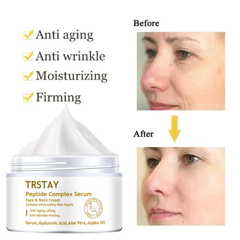 Anti Wrinkle Peptide Essencial Cream Face Cream Collagen Whitening Acne Scar Removal Cream For Face Skin Care