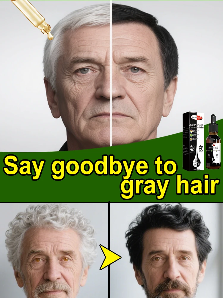 

White fades away, black hair finds its way back