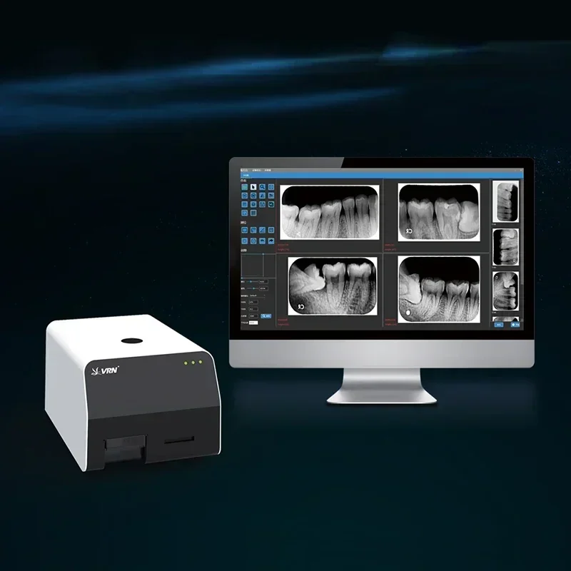 VRN EQ-600 Captures Super-Defined, Gentle Dental Scans, Quicker Rendering, Higher Accuracy 16Bit Grayscale as Diagnostic Aid