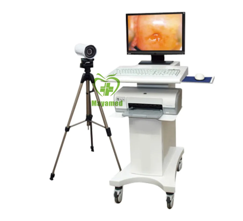 China video colposcopio digital goldway price wireless mini camara gynecology precio portatil usb medical colposcope