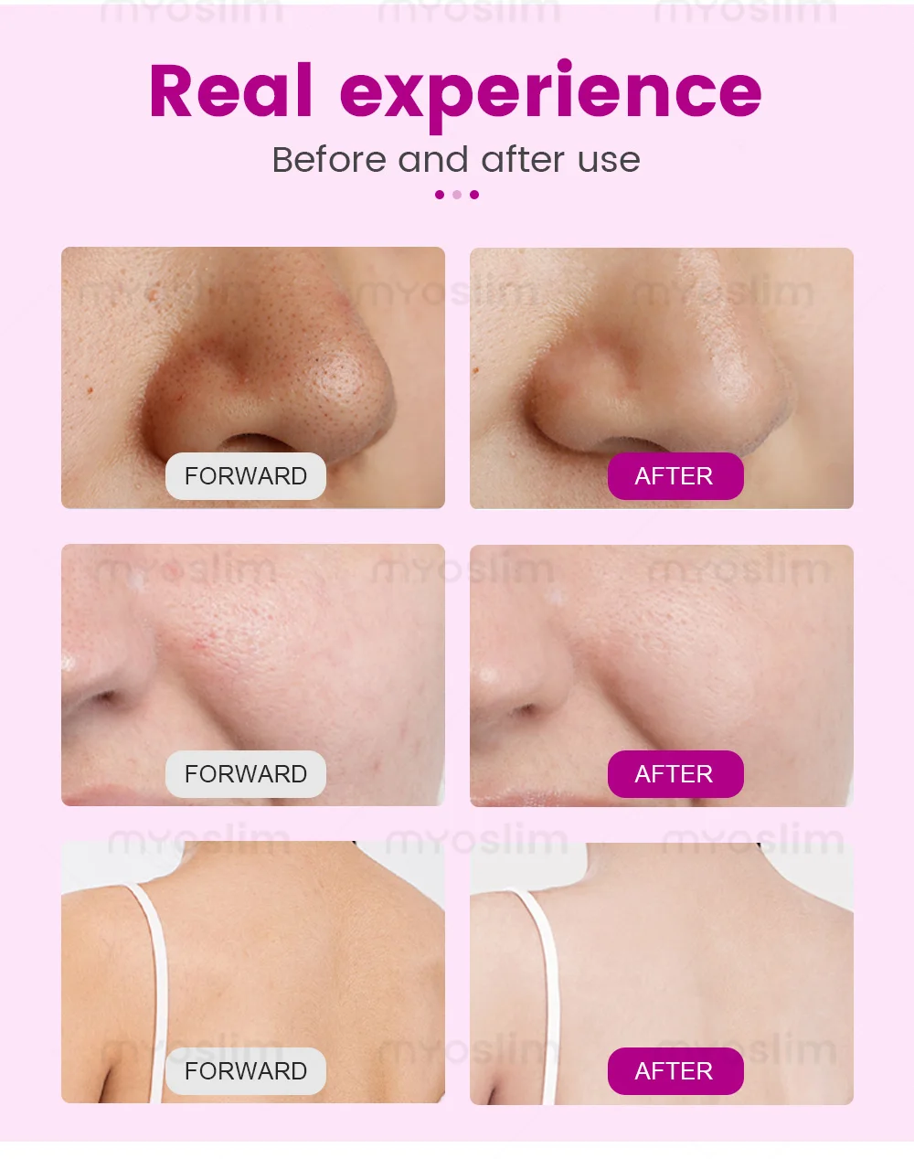 전문 미용 다기능 페이셜 스킨케어 기계: 딥 하이드레이션 하이드라 옥시젠 페이셜 스킨케어 기계, 피부 클렌징