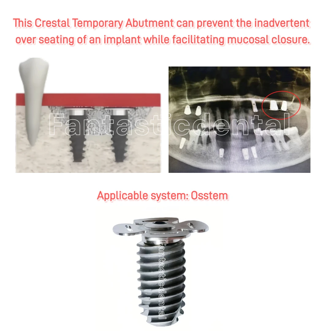 Dental Crestal Temporary Abutments Thin Sinus Lift Temporary Abutments Fits OSS Wide Cap Closure Screw