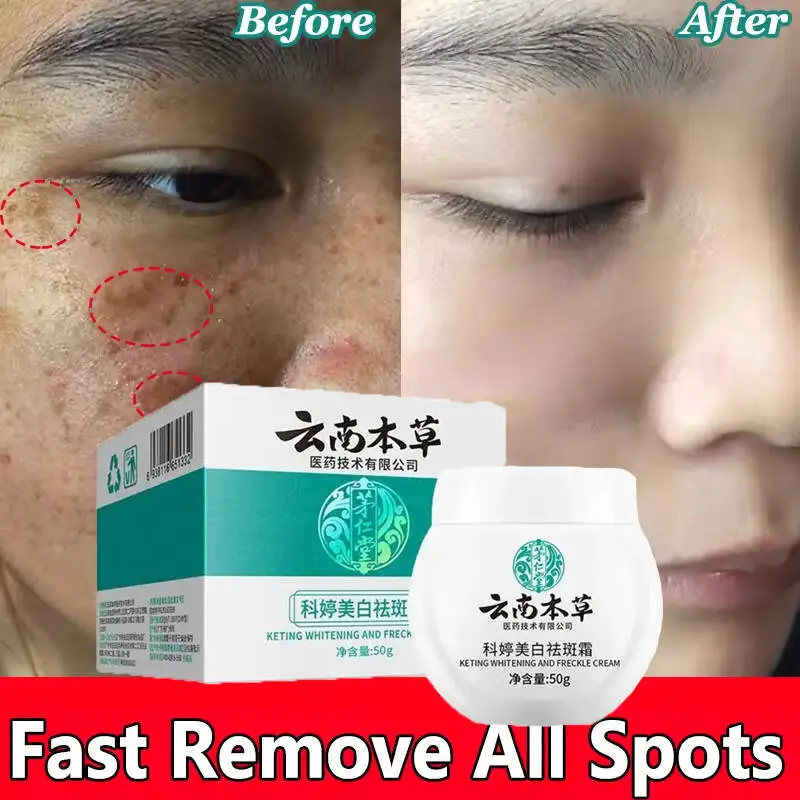 

Vitamin C Whitening Freckles Face Cream Remove Melasma Dark Spots Lighten Melanin Acne Scar Anti-aging Brighten Face Skin Care